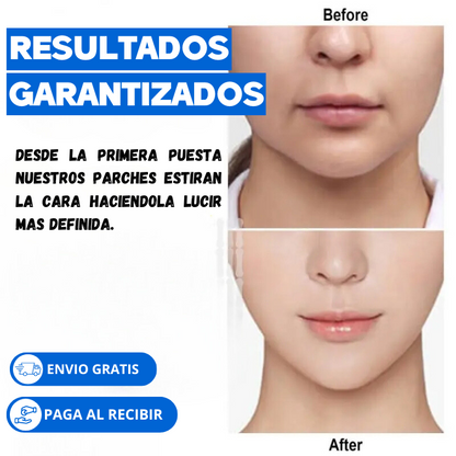 FACE LIFTING PATCH™ Parches Invisibles de Estiramiento Facial - IMPORTADO DESDE ESTADOS UNIDOS